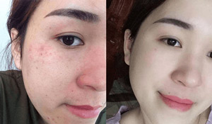 Khách hàng Minh Phụng đánh giá Dr Skincare