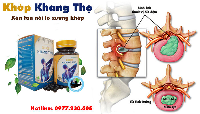 Khớp Khang Thọ